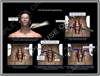 Custom Illustrations